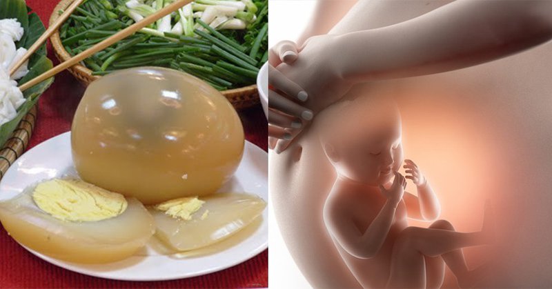 Hạn chế dị tật bẩm sinh thai nhi